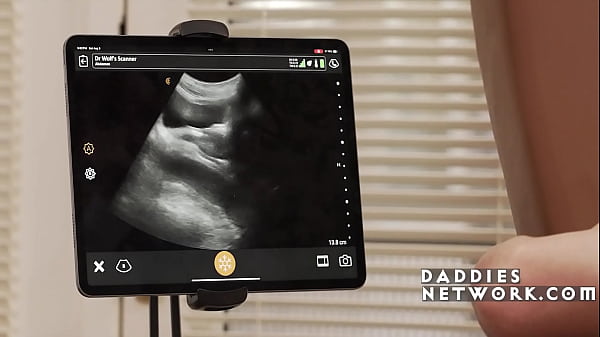 Doctor'_s Special Anal Ultrasound Dickment